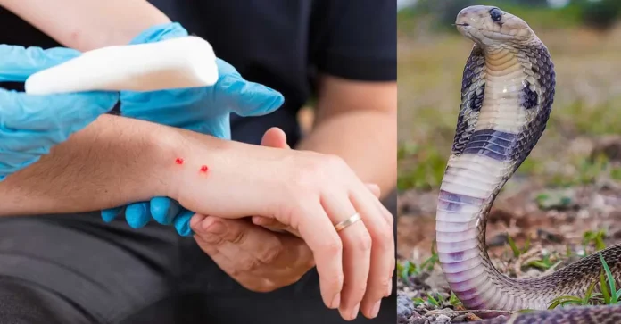 snake-bite-treatment