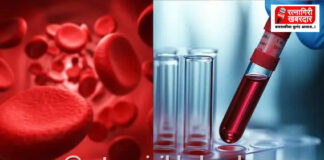 JAMA New Blood Group: रक्ताचा नवा ब्लड ग्रुप शोधण्यात यश; विज्ञानाच्या जगात ‘जामा’ (JAMA) ठरली ४९ वी मानवी रक्तगट प्रणाली