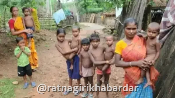 Child malnutrition survey: रत्नागिरी जिल्ह्यातील ९१ टक्क्यांहून अधिक बालके निरोगी; कुपोषण निर्मूलनासाठी आरोग्य विभाग सक्रिय Child malnutrition survey: रत्नागिरी जिल्ह्यातील ९१ टक्क्यांहून अधिक बालके निरोगी; कुपोषण निर्मूलनासाठी आरोग्य विभाग सक्रिय